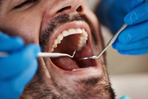 Best Emergency Dental Care for Sports Injuries in Butner, NC